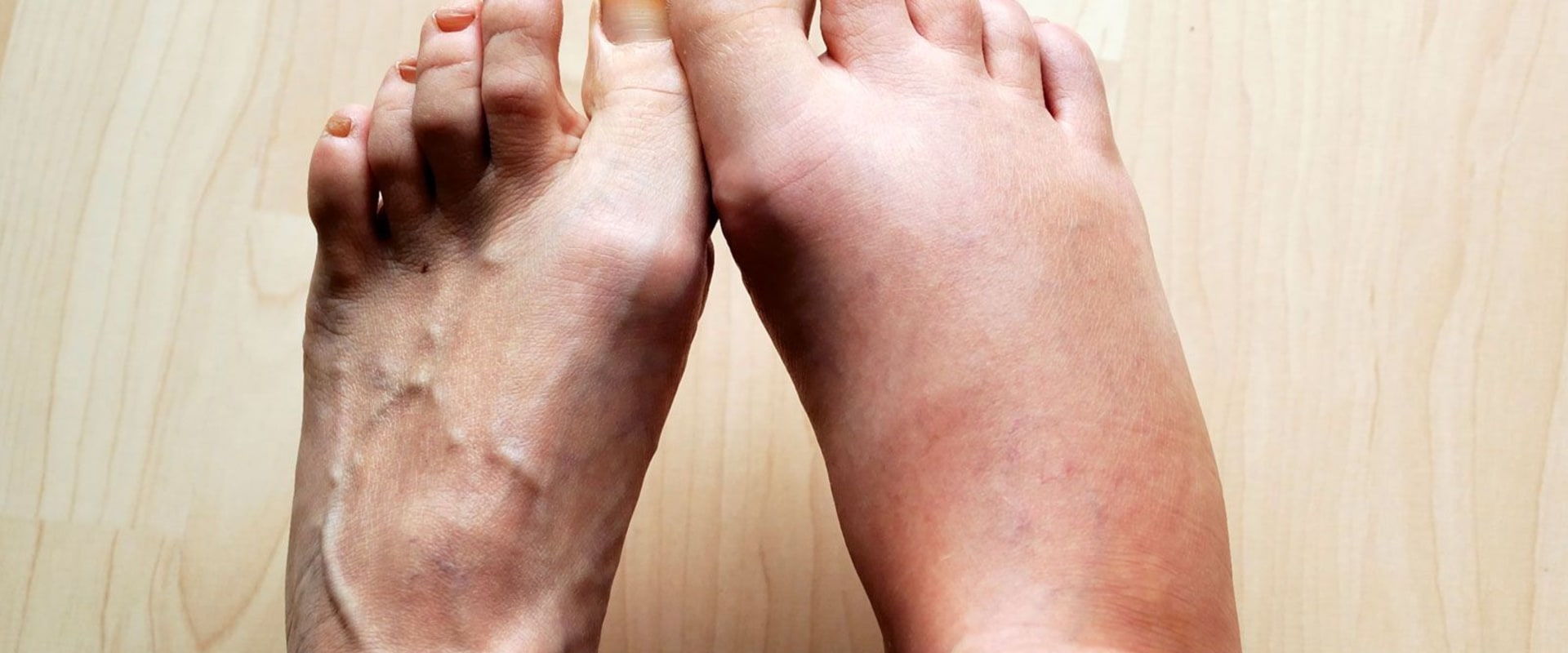 Understanding Swelling and Discomfort