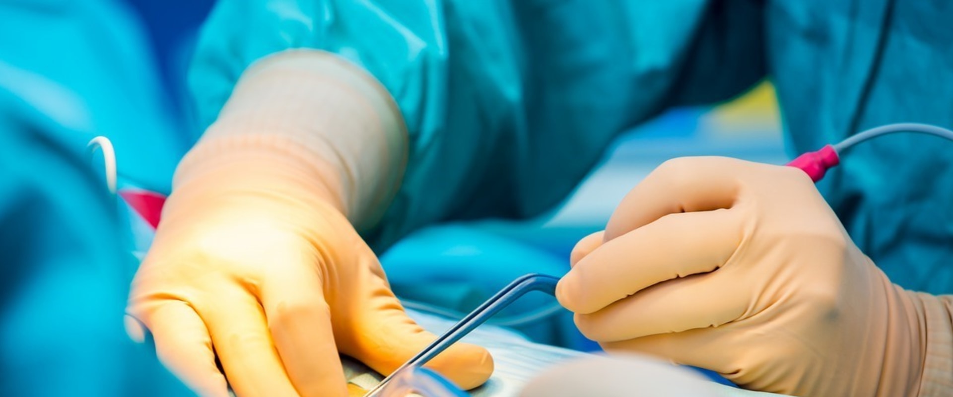 Understanding Electrocautery: Everything You Need to Know
