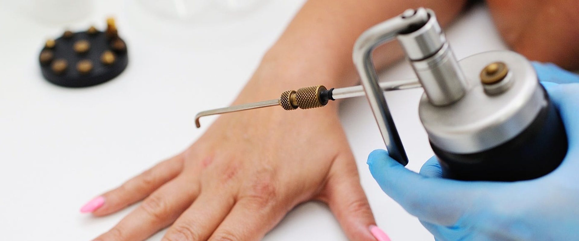 Cryotherapy: Exploring Medical Treatments for Genital Warts Removal