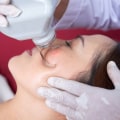 Laser Treatment: A Comprehensive Overview