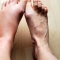 Understanding Swelling and Discomfort