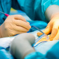 Understanding Electrocautery: Everything You Need to Know