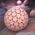 Cryotherapy for Genital Warts: What You Need to Know