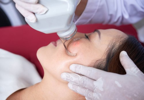 Laser Treatment: A Comprehensive Overview