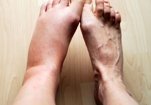 Understanding Swelling and Discomfort