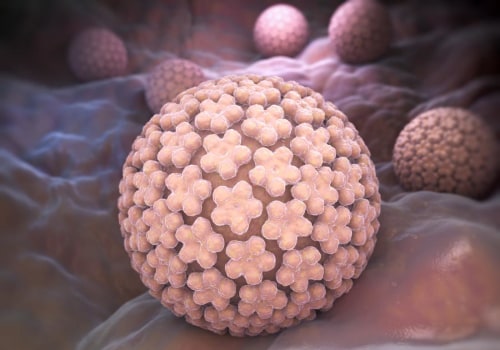 Cryotherapy for Genital Warts: What You Need to Know